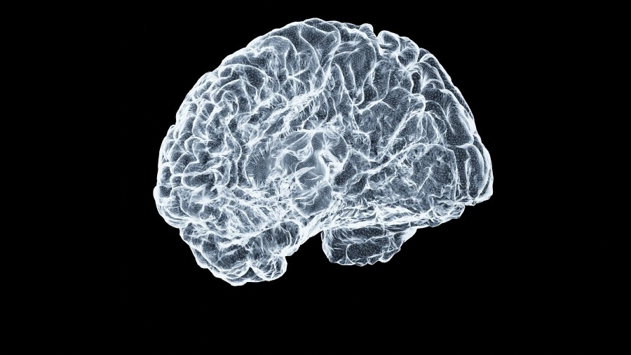 X-ray image of a human brain